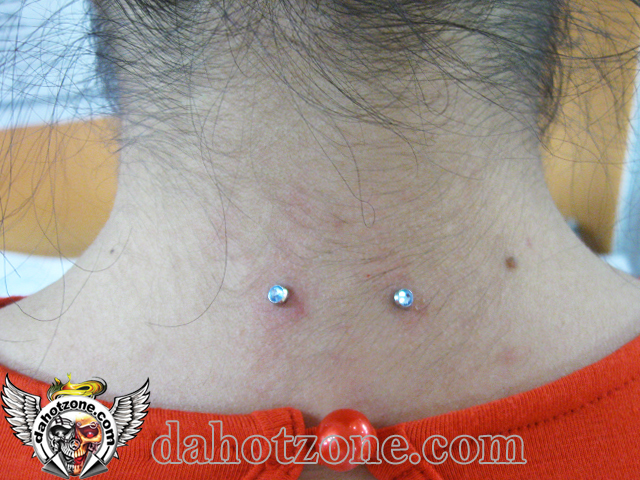 Double microdermal