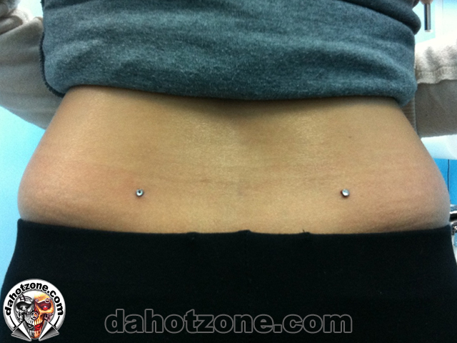 back dimples microdermals