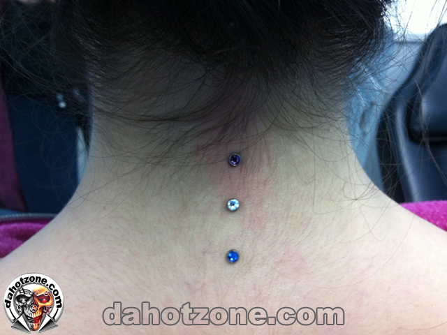 nape dermals