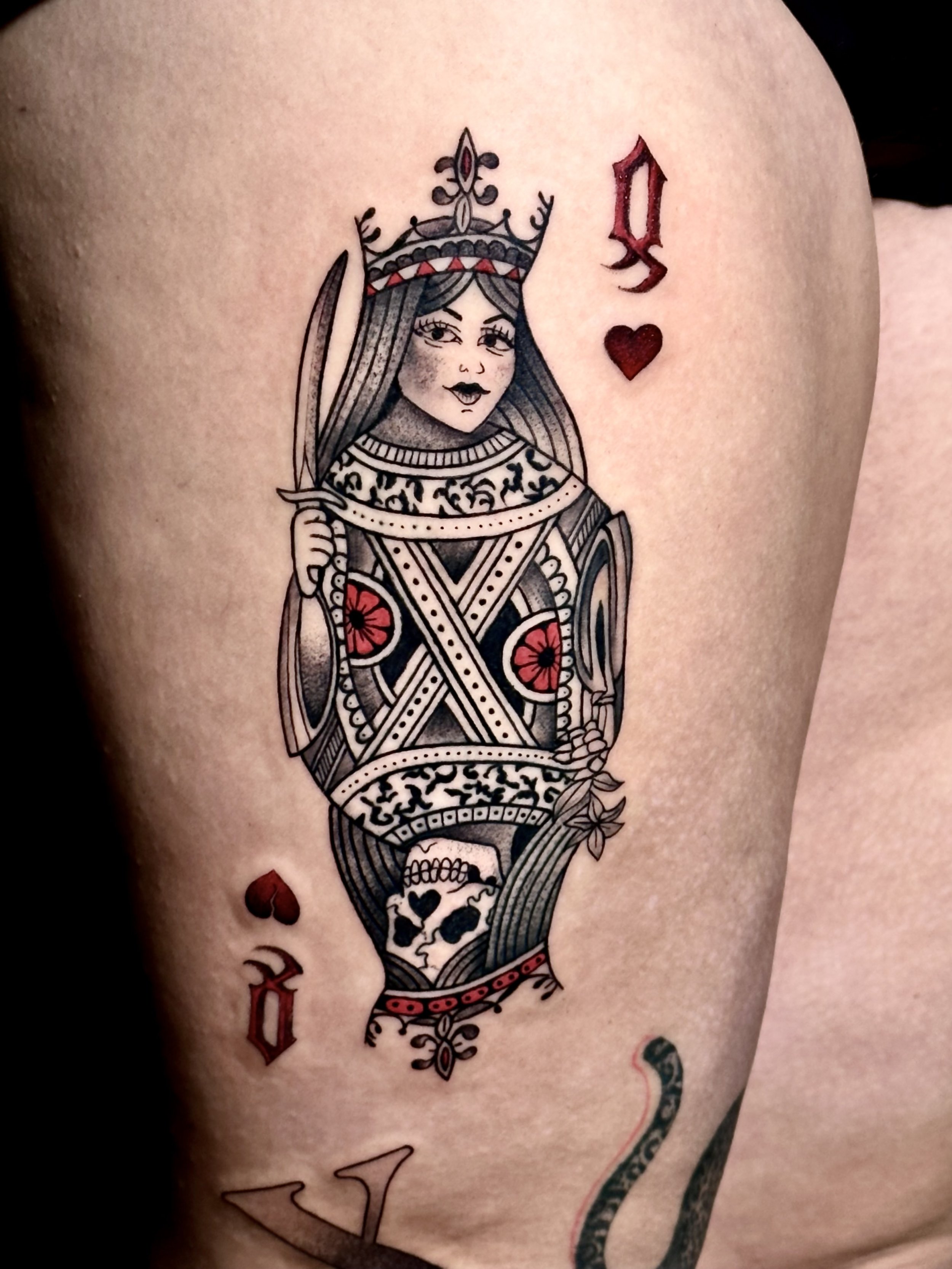 Heart of queens