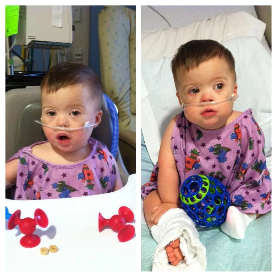 This cutie took 3 years to learn how to swallow without aspirating. He needed thickener in each drink and now we never take for granted a simple glass of water. Pneumonia and RSV had him in this cute gown for a week.