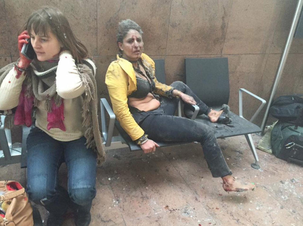 Women injured during the terrorist attack on the airport in Zaventem, Belgium in March 2015 (Ketevan Kardava, Facebook)