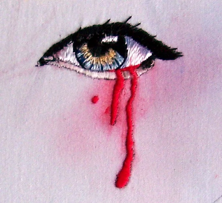 “Bleeding Eye” by C. Bayraktaroglu