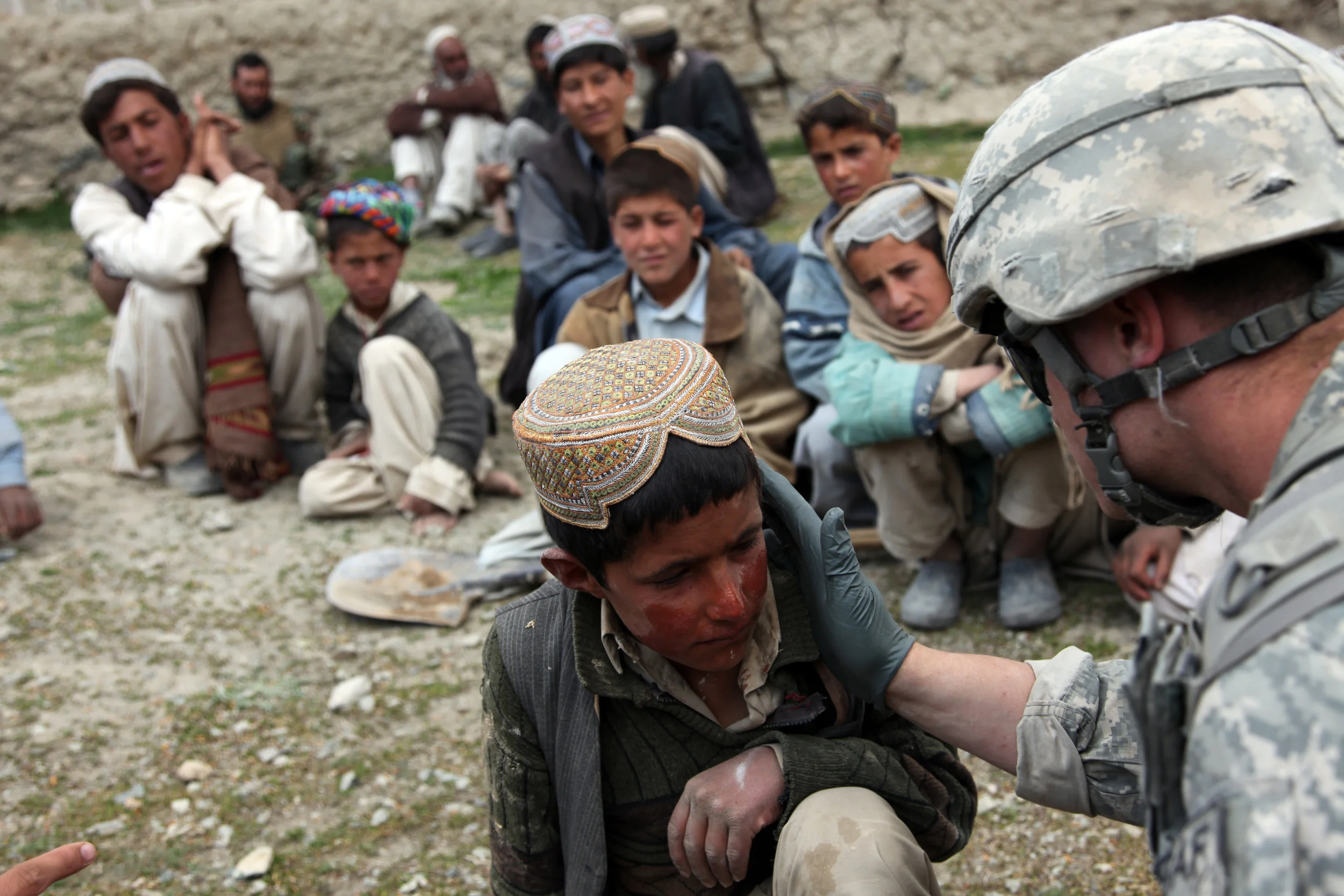 A U.S. Army medic treats an Afghan child for a sunburn in the village of Meryanay Kherwar District, Logar province, Afghanistan, April 9. (ISAF Public Affairs Photo/Wikimeida)