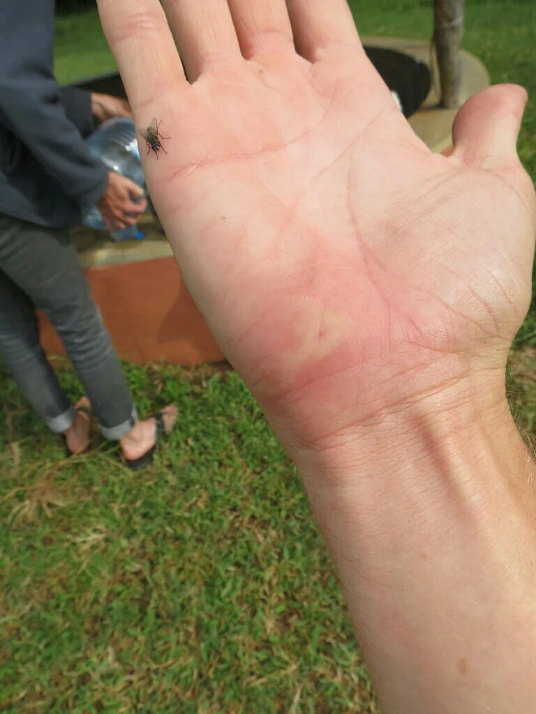 Ouch.