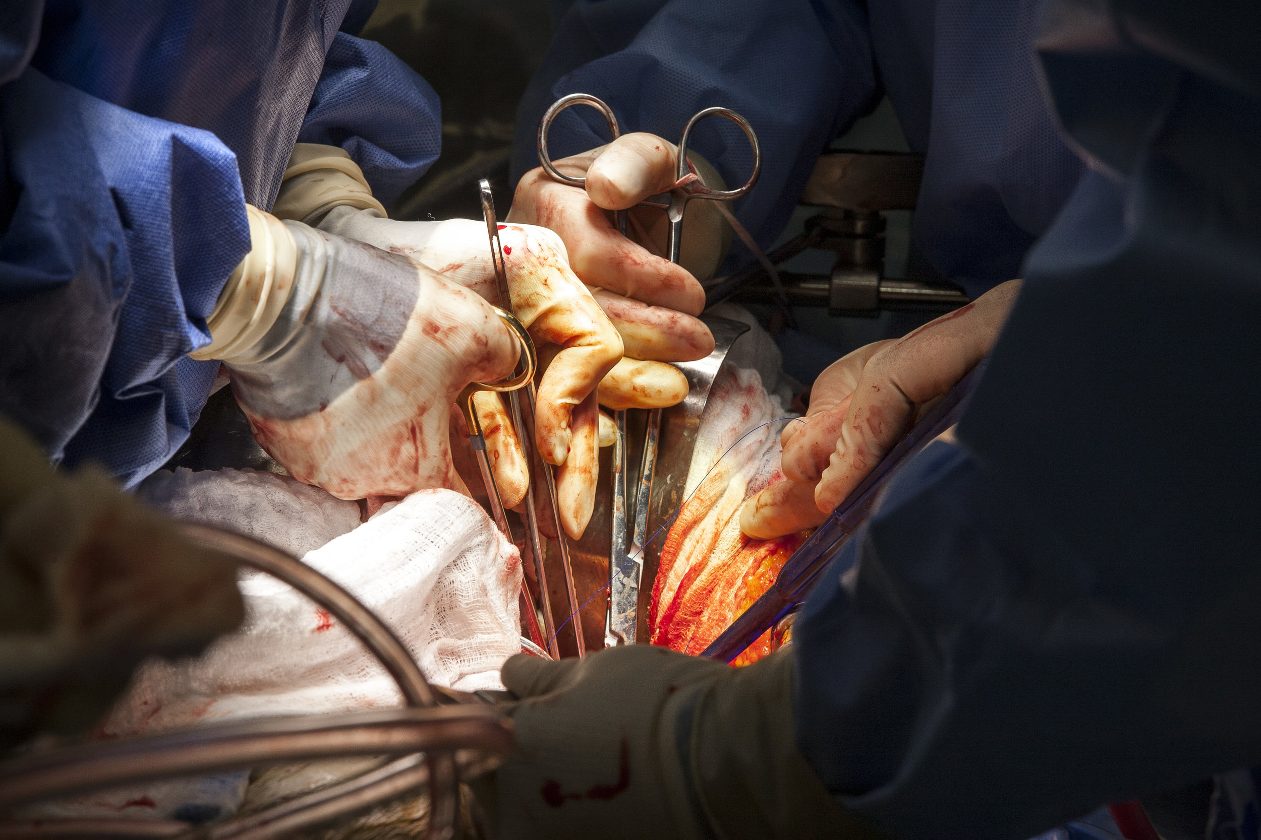  Dr. Quynh Feikes performs a surgery to fix an abdominal aneurysm at University Medical Center on Tuesday, May 23, 2017. Dr. Feikes is the only female cardiac surgeon in Nevada. Patrick Connolly Las Vegas Review-Journal @PConnPie 