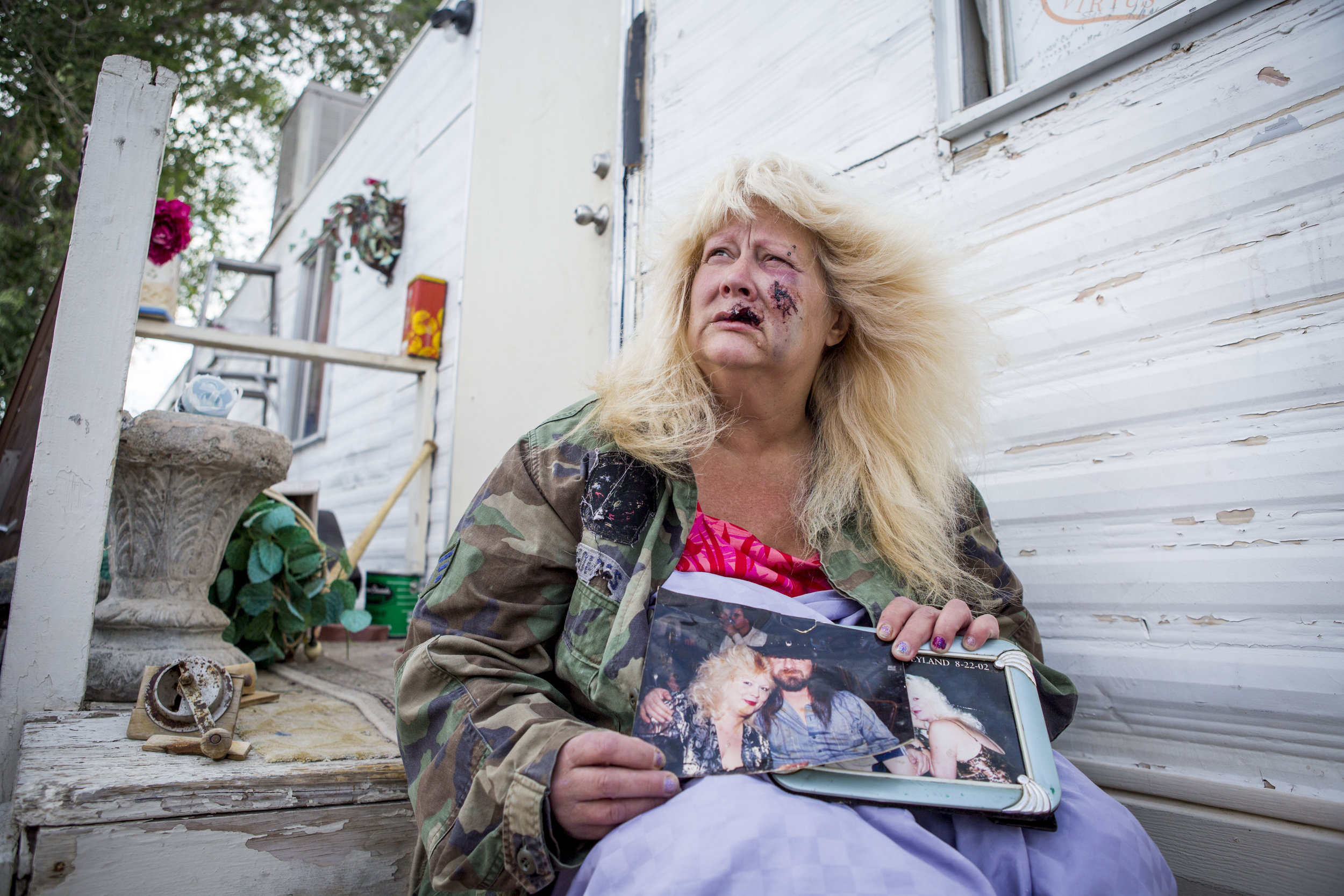  Joan Hobbs, 53, holds photos of herself outside of her home before she was bitten by a dog in northeast Las Vegas Tuesday, May 9, 2017.&nbsp;"I didn't used to be ugly," she said. "Now I am, and it's not my fault." 
