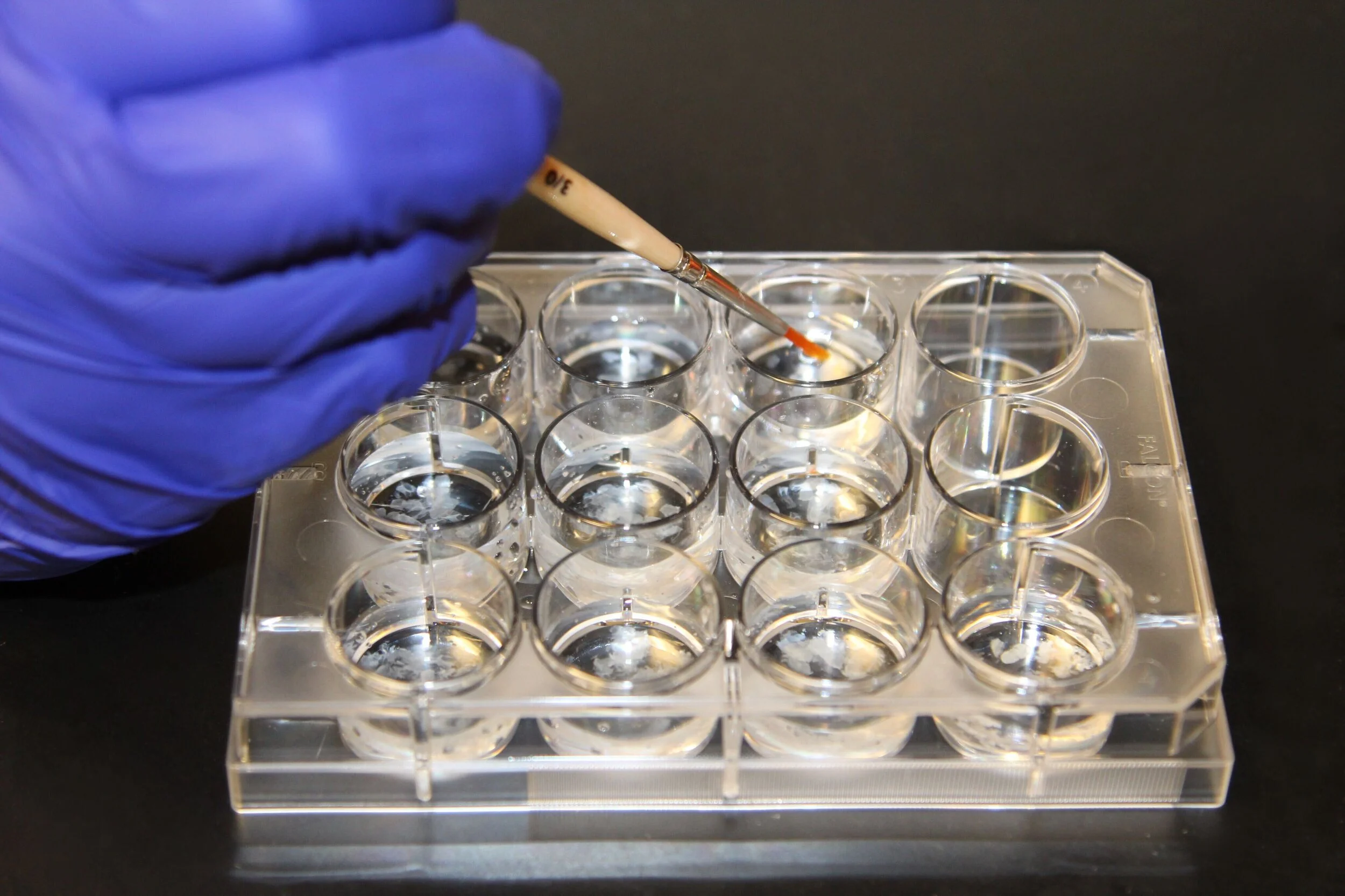 BRUCHAS LAB