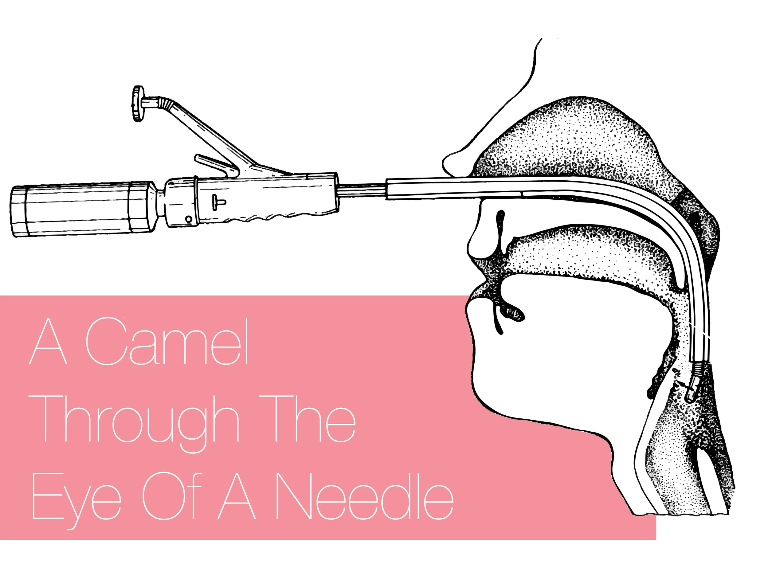 A Camel Through the Eye of a Needle (or A Tube Through the Nose of a Sick Patient)