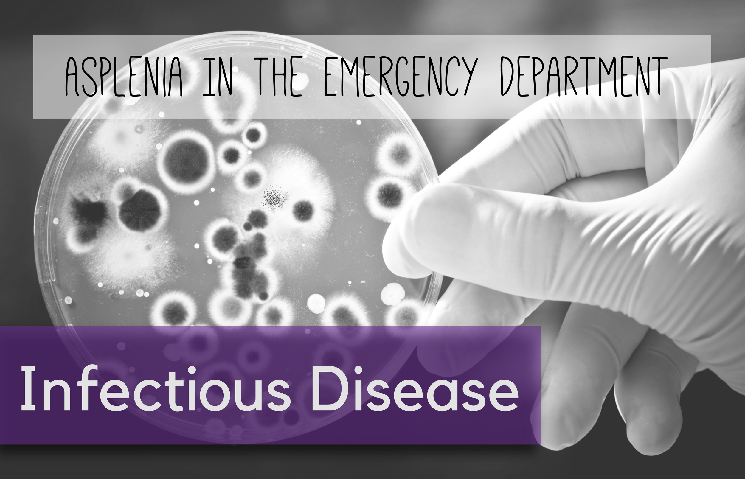 Written by : Will LaPlant, MD (EM Resident Physician, PGY-1, NUEM); Edited by : Andrew Moore, MD (EM Resident Physician, PGY-3, NUEM); Expert Commentary by : Brian Wolf, MD