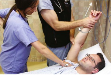 Figure SEQ Figure \* ARABIC 4 : Milch Technique. Adapted from Horn, A., & Ufberg, J. (2013), Management of Common Dislocations. In Roberts and Hedges' Clinical Procedures in Emergency Medicine (6th ed.). Philadelphia, PA: Elsevier/Saunders.