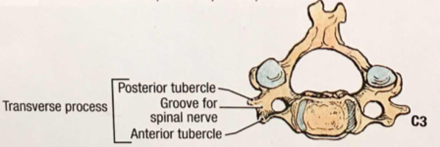 Unstable Cervical Spine Fractures — NUEM Blog