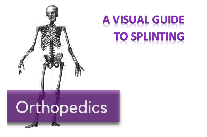 Visual Guide to Splinting — NUEM Blog