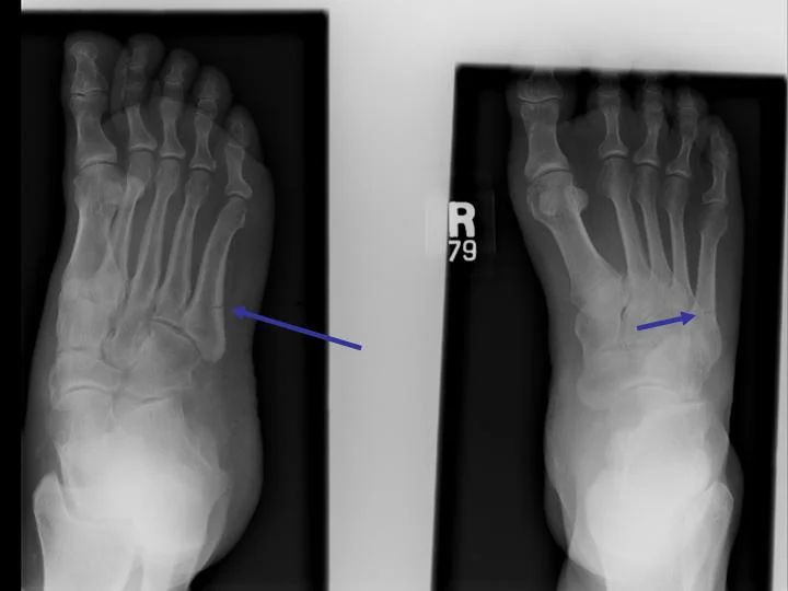 Foot 2.jpg