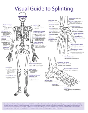 Visual Guide to Splinting — NUEM Blog