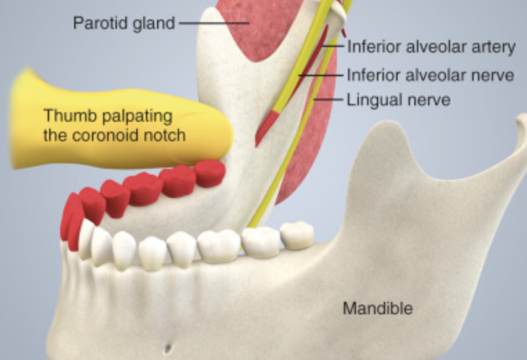 Inferior Alveolar Nerve Block Anatomical Landmarks - vrogue.co