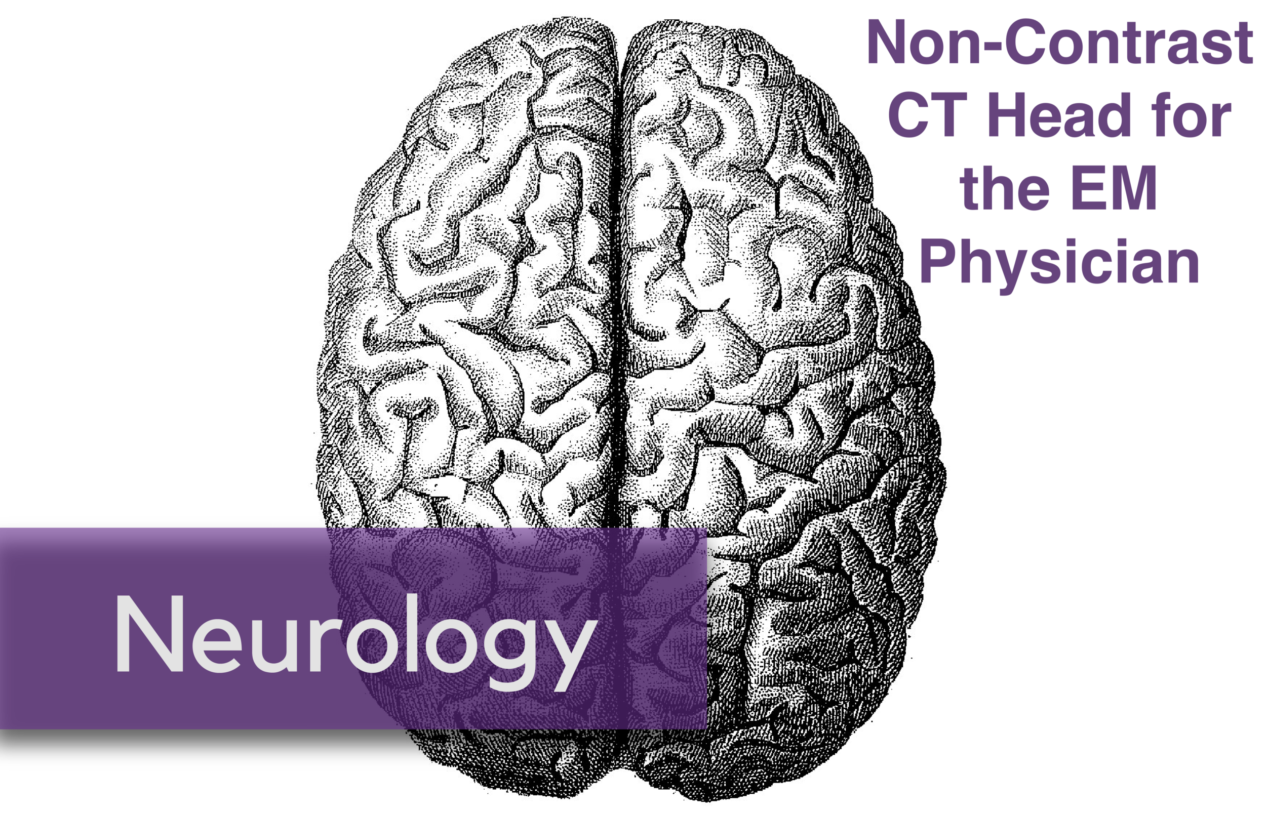 The Migraine Cocktail Emergency Department Management of Headaches