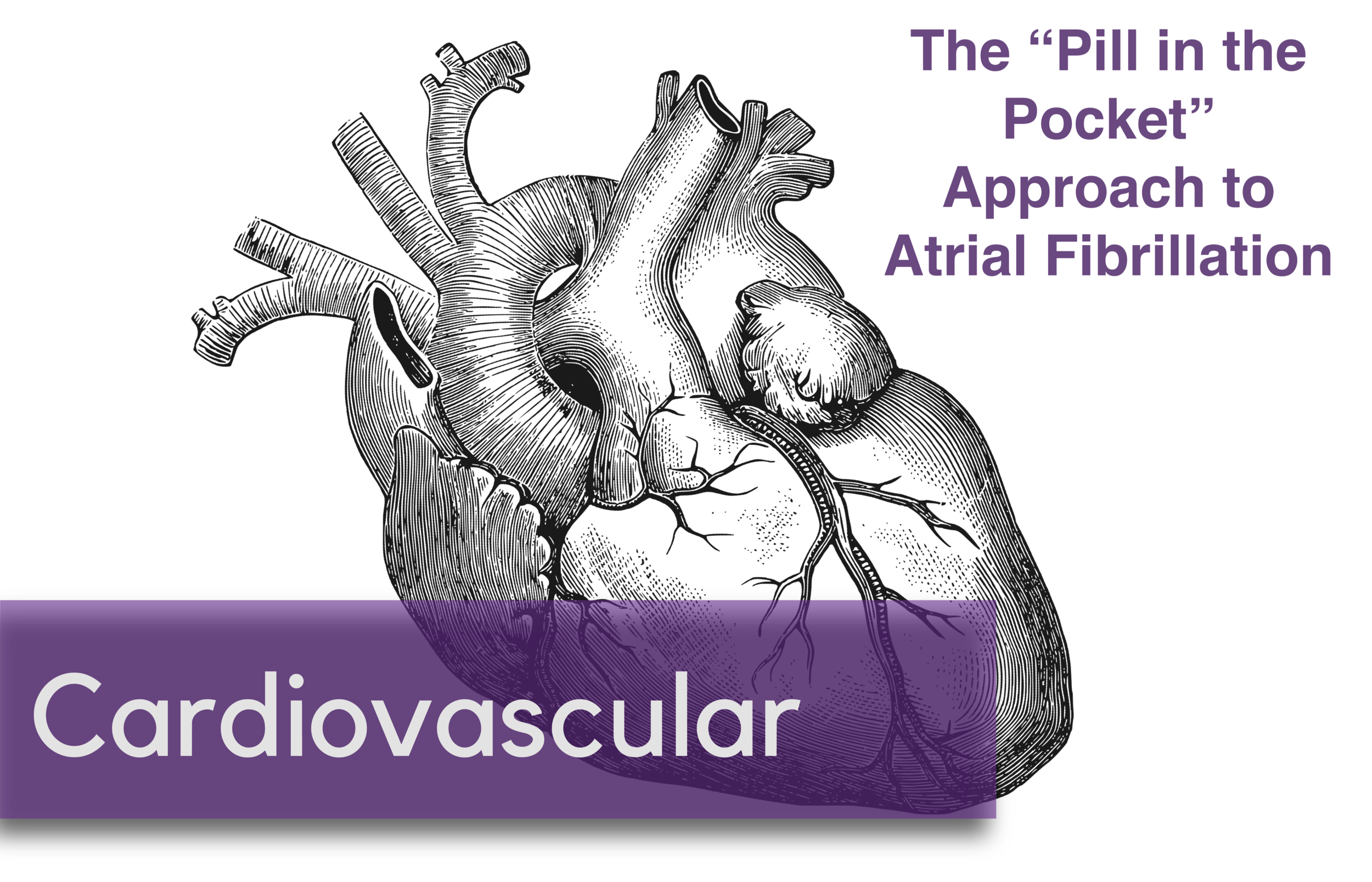 A “Pill-in-the-Pocket” Approach to Paroxysmal Atrial Fibrillation — NUEM  Blog