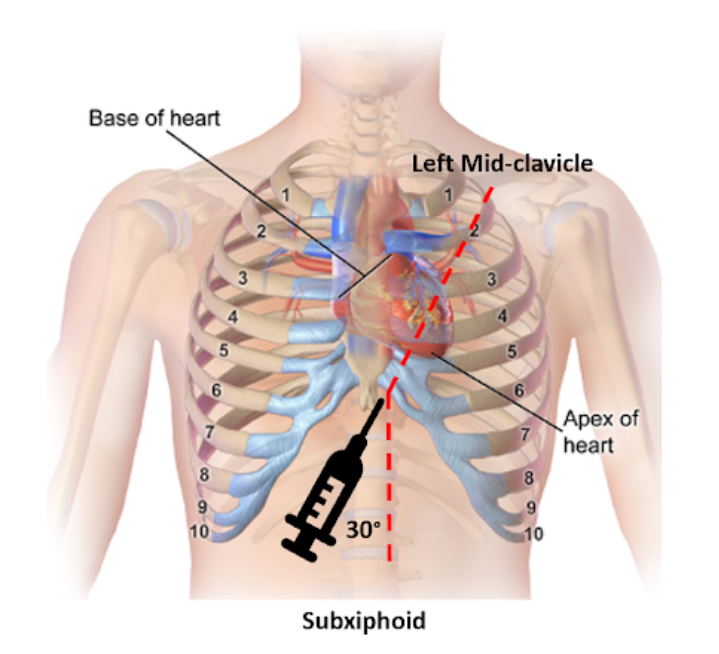 procedures — Blog — NUEM Blog