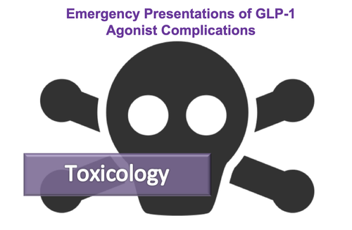 glp-1 nausea lawsuit in kentucky Emergency Presentations of GLP-1 Agonist Complications — NUEM Blog