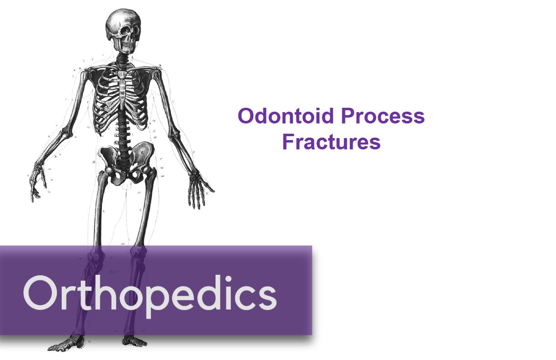 Odontoid Process Fractures