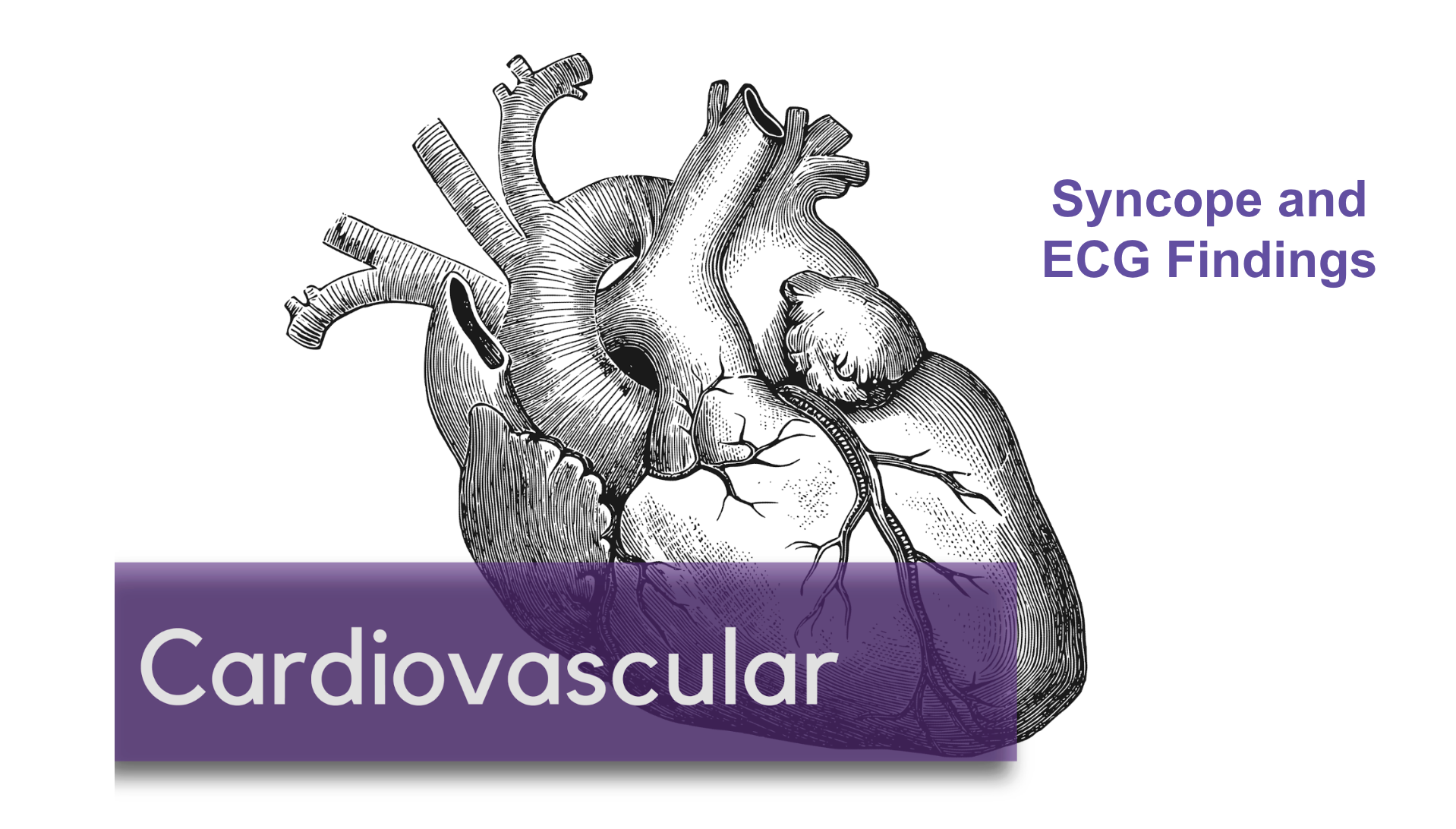 Syncope and ECG Findings
