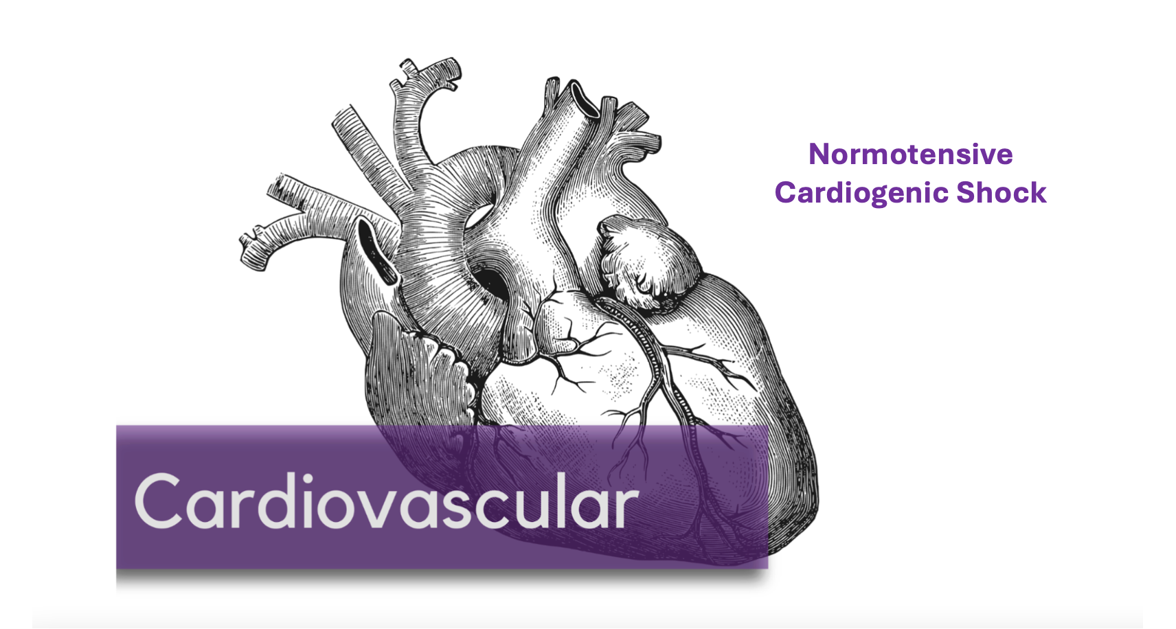 Normotensive Cardiogenic Shock