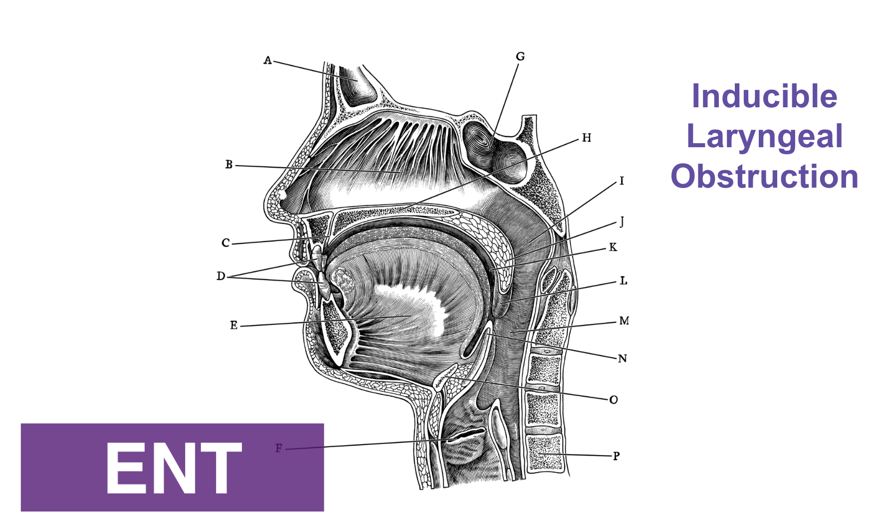 Inducible Laryngeal Obstruction (ILO)