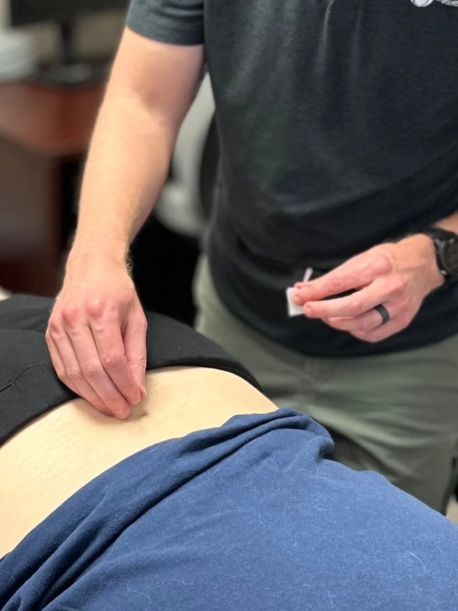 A person performing a physical therapy or medical procedure on a patient lying face down, with a healthcare worker's hand on the patient's lower back.