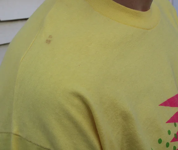 spot on shoulder .jpg