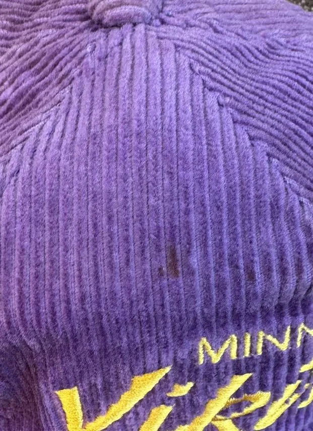 spot on hat.jpg