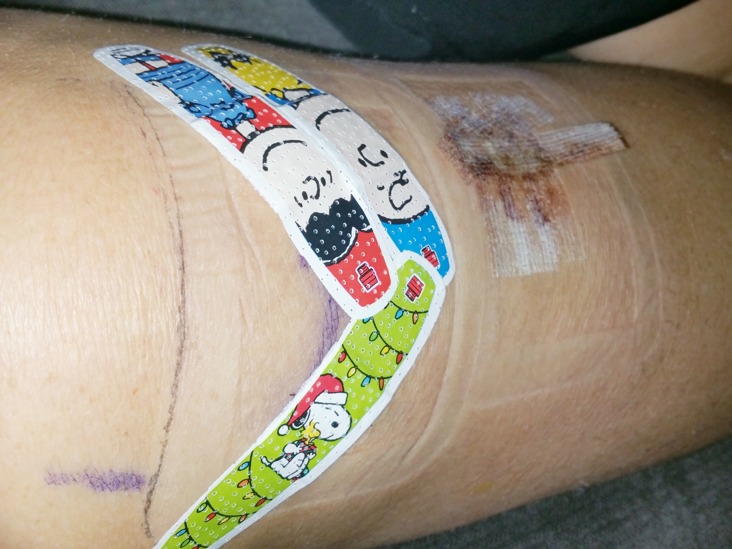 Because regular band-aids are boring #snoopy