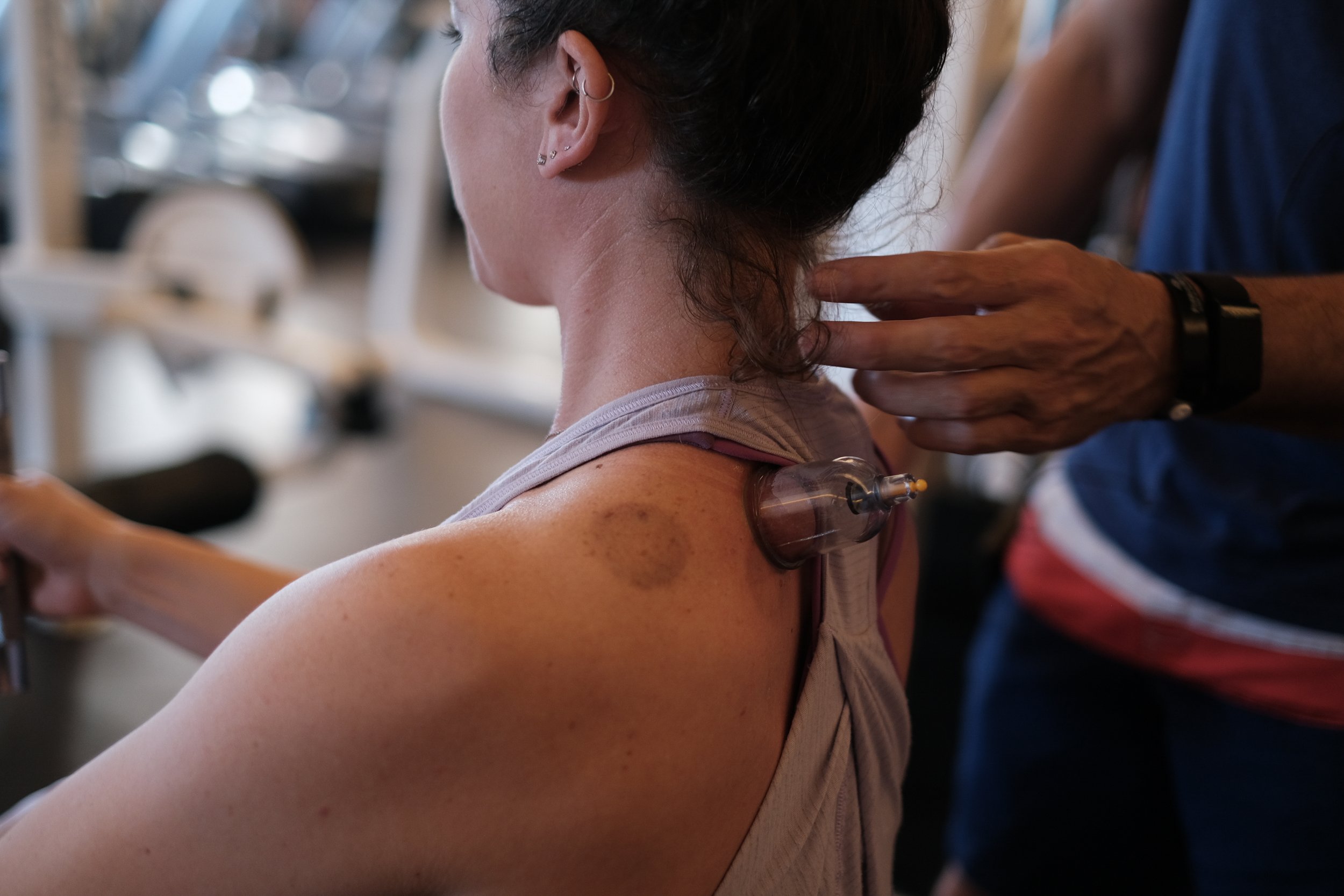 Chris Daprato MFD course in Cupping
