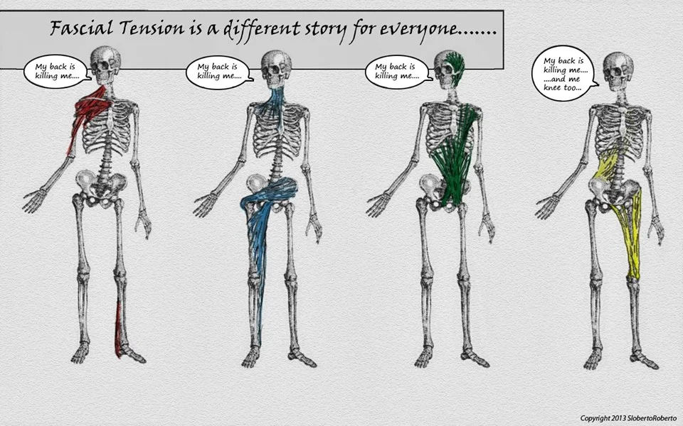 illustration by fellow MFR therapist Rob Crampton . This shows how the root cause of back pain can be anywhere in the body, yet rarely is a whole body approach taken in Western medicine.