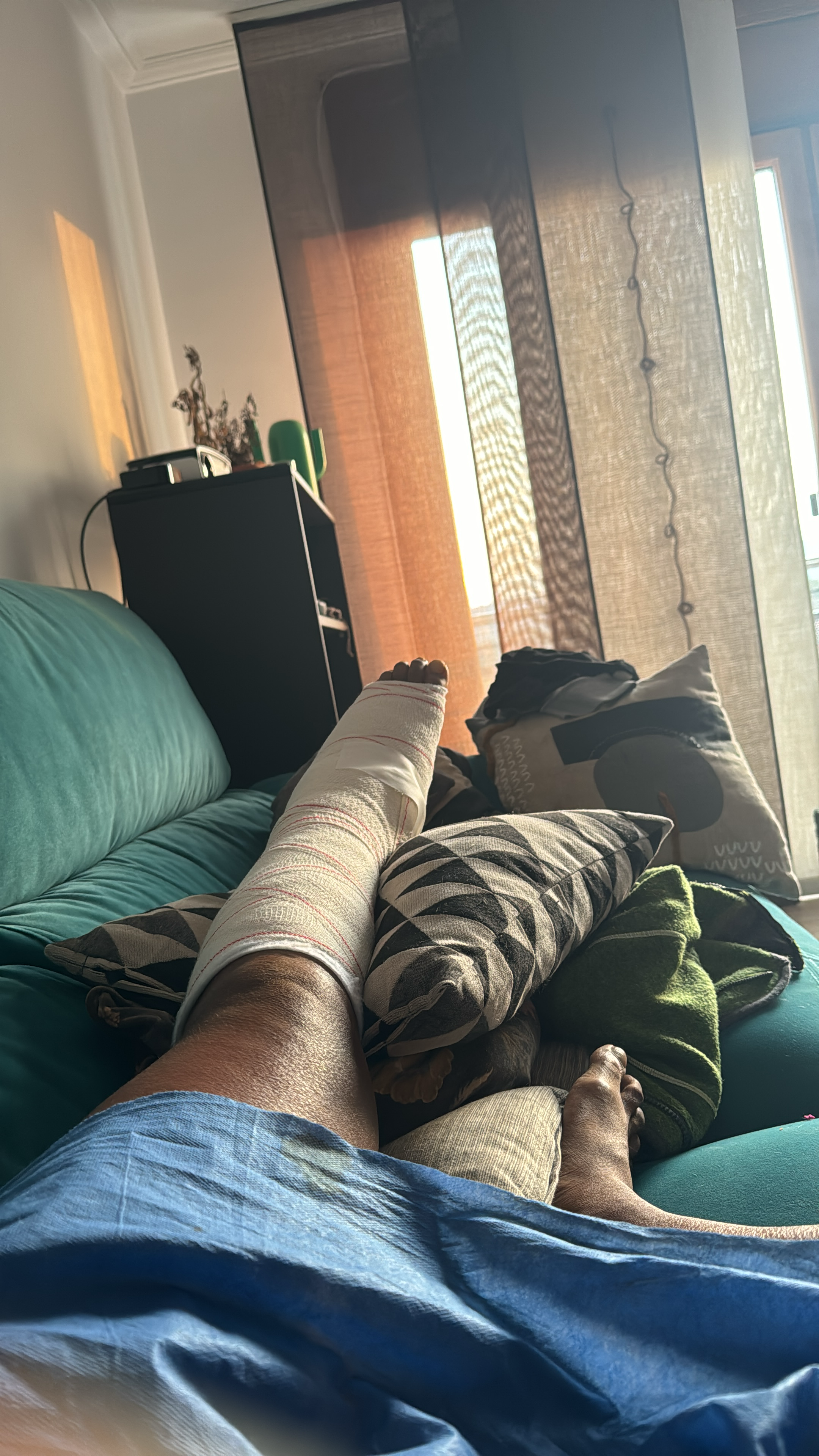 Laid up with a broken ankle