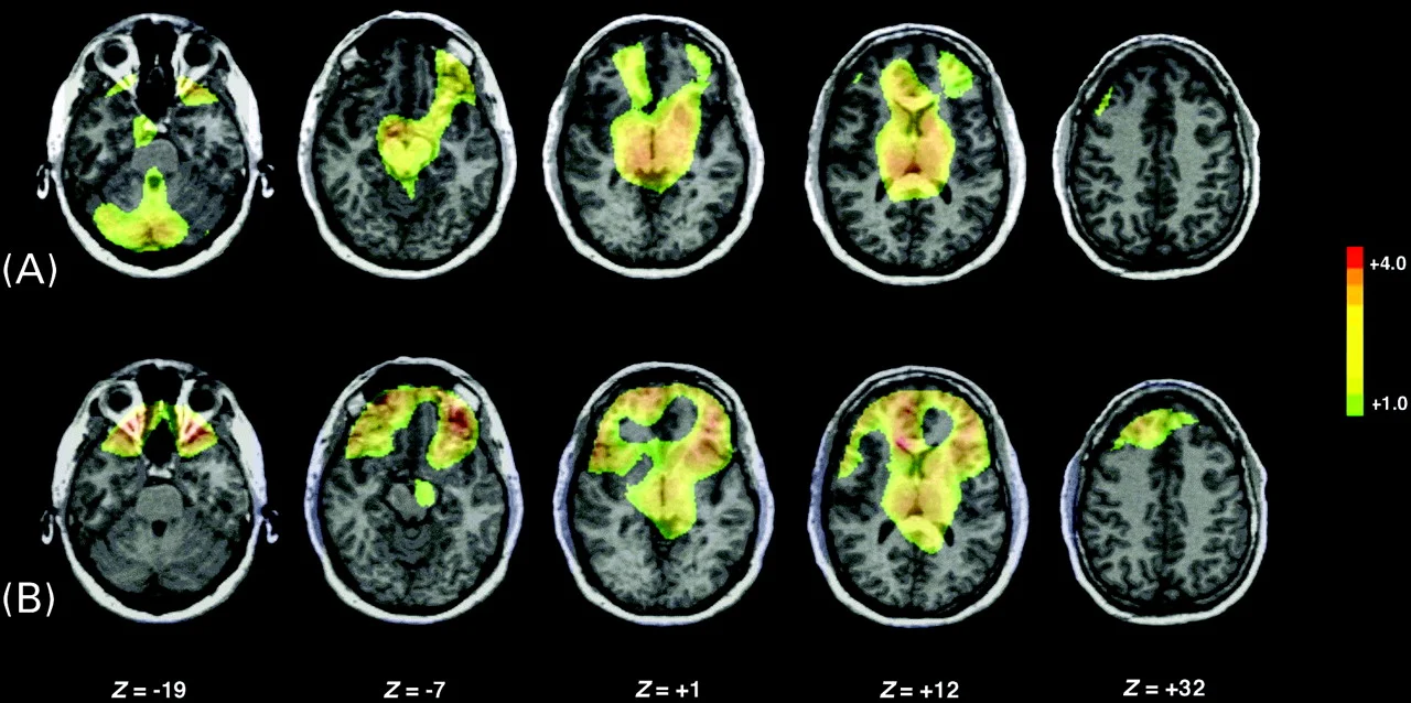 De chemie van verbinding...mogelijk gemaakt door een verhaal