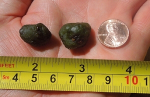 Liver stones