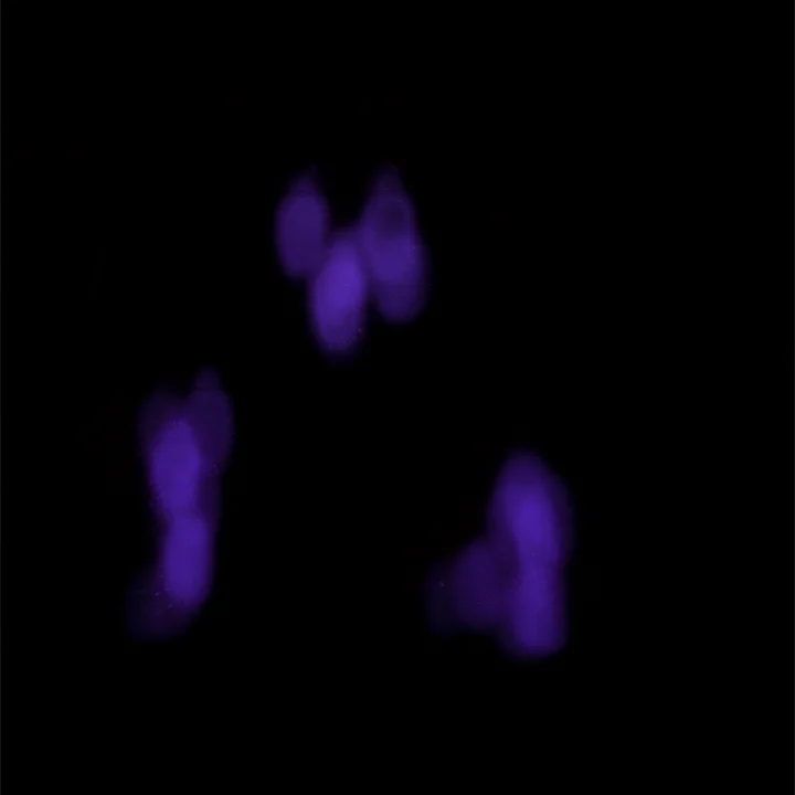   Kirlian Photograph of my Index Finger , 2016 