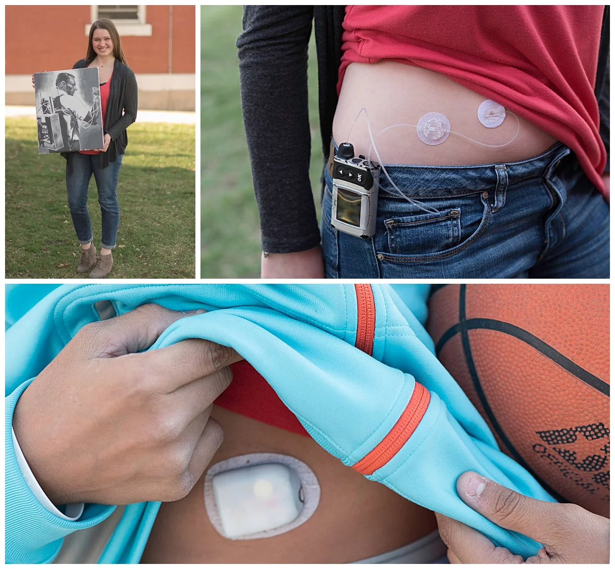 Insulin pumps from the very first backpack pump to the smaller pumps in use today. (c) Rebecca LaChance, 2016. Kansas City, MO. Taylor is grateful for today's smaller pumps. Luke's pump is powered by Bluetooth technology.