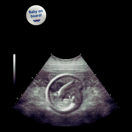 Alien-on-Board-Ultrasound-Avatar-433px.png