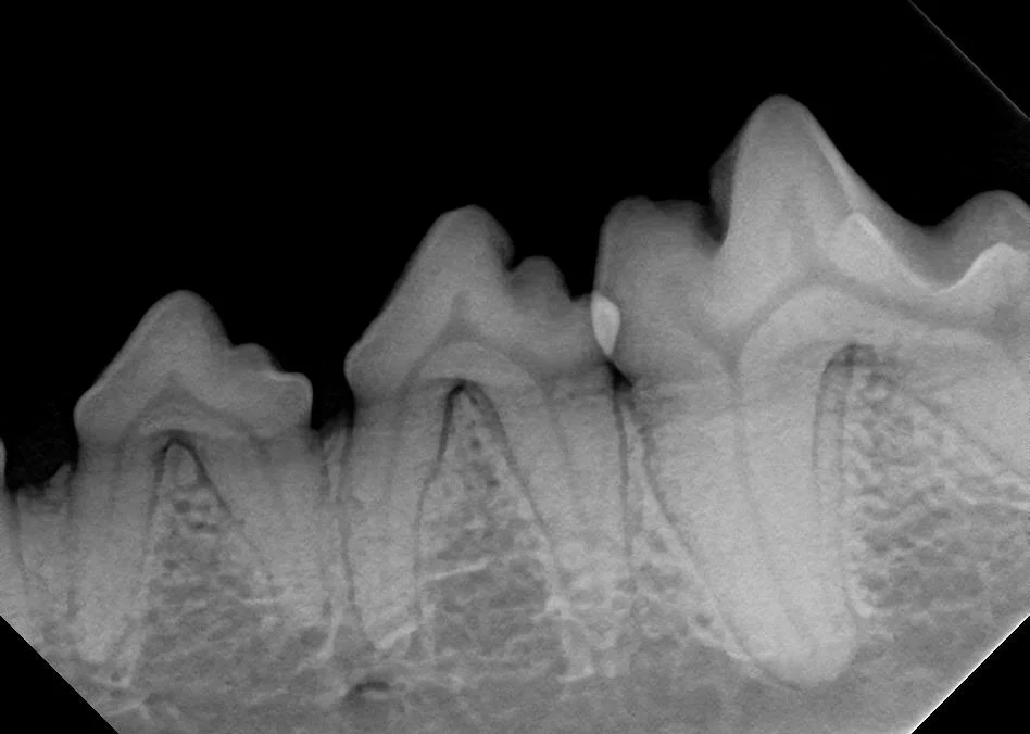 Healthy teeth with good roots.