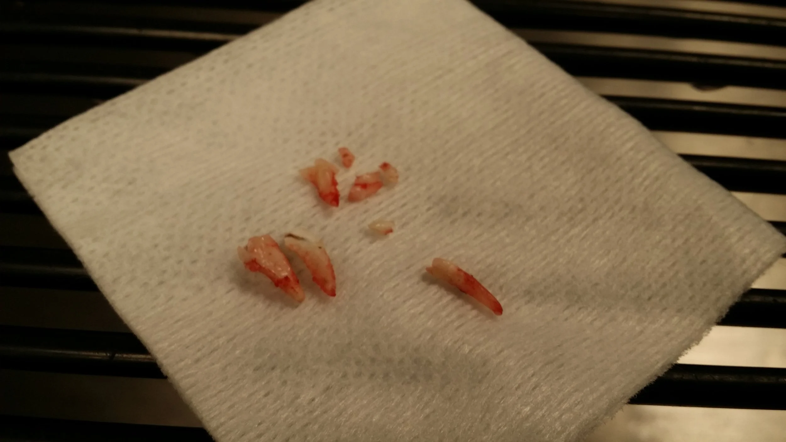 Baby teeth and an abscessed tooth that had to be cut in half prior to extraction. (Not Kit Kat's teeth)