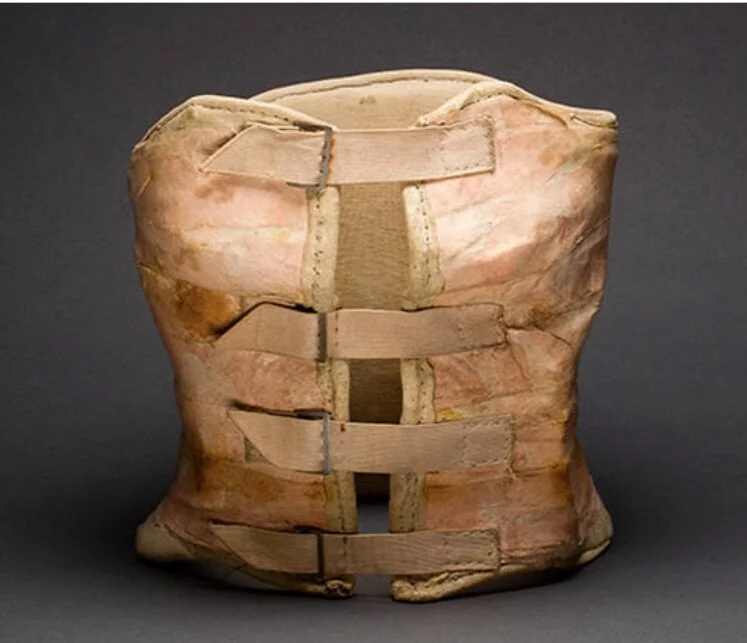 Inspiration for Plaster No. 1