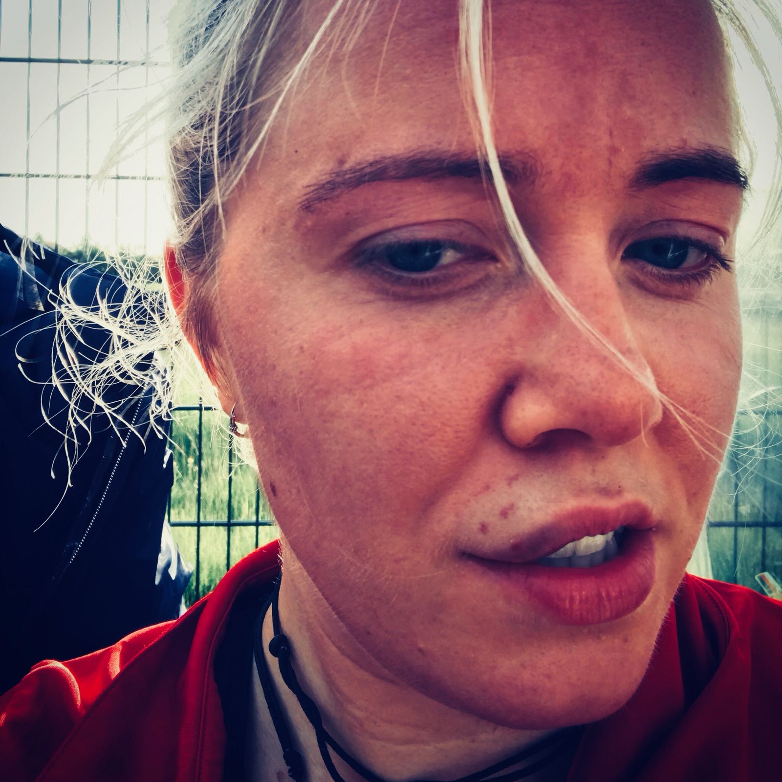 Chloe after being hit by a ball in the mouth.
