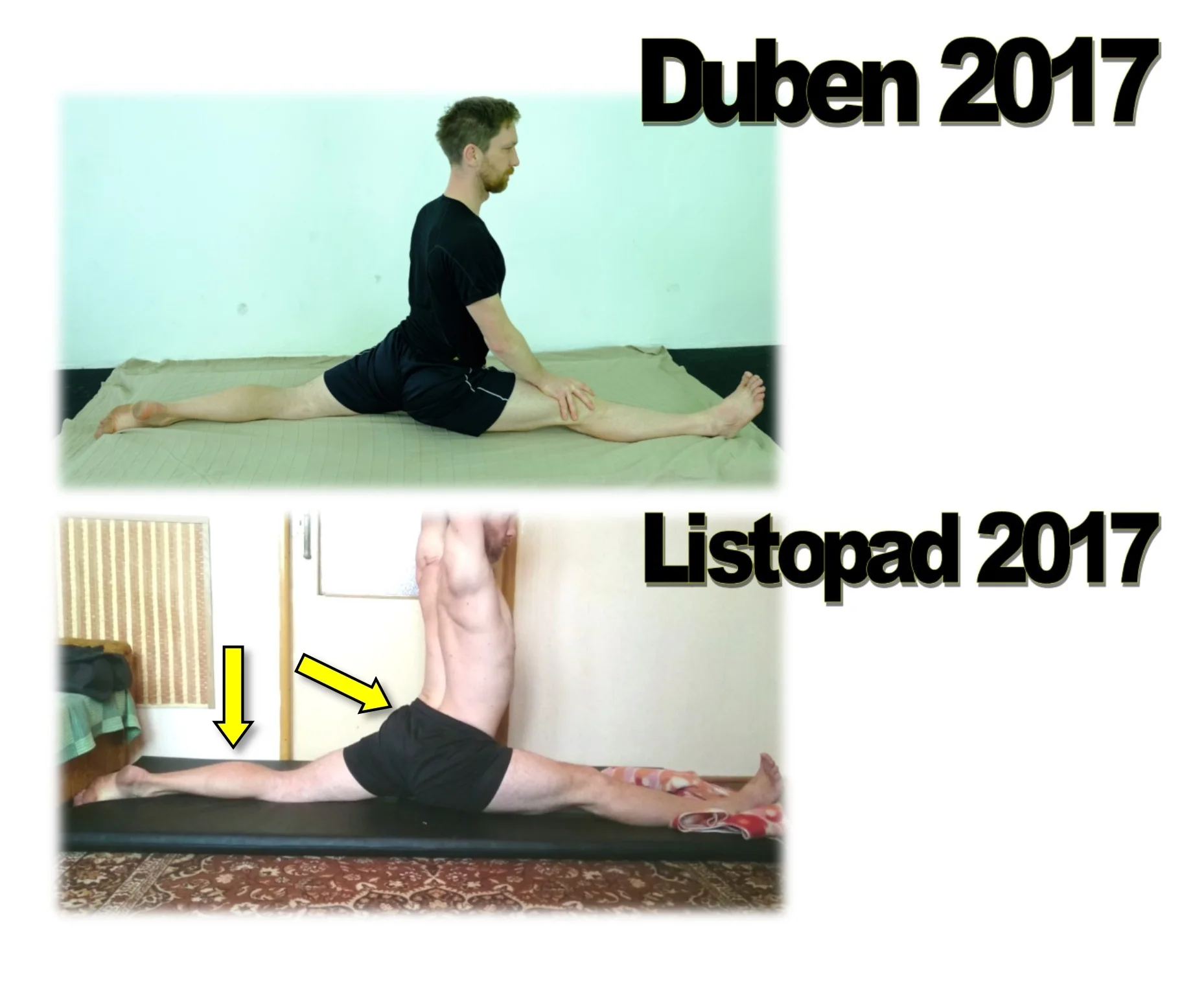 RF Before After 6 months splits + ARROWS.jpg