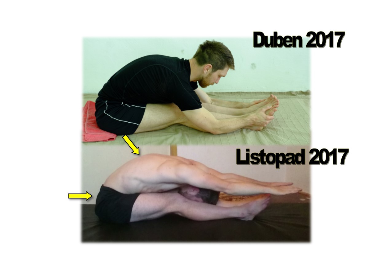 Before After Pike 6 Month progress + ARROWS.jpg