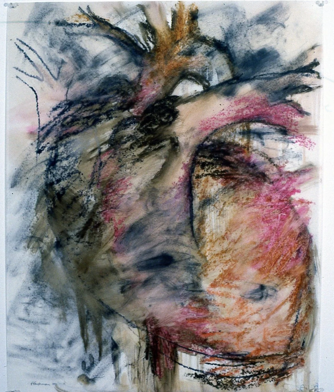 Anterior Heart #1