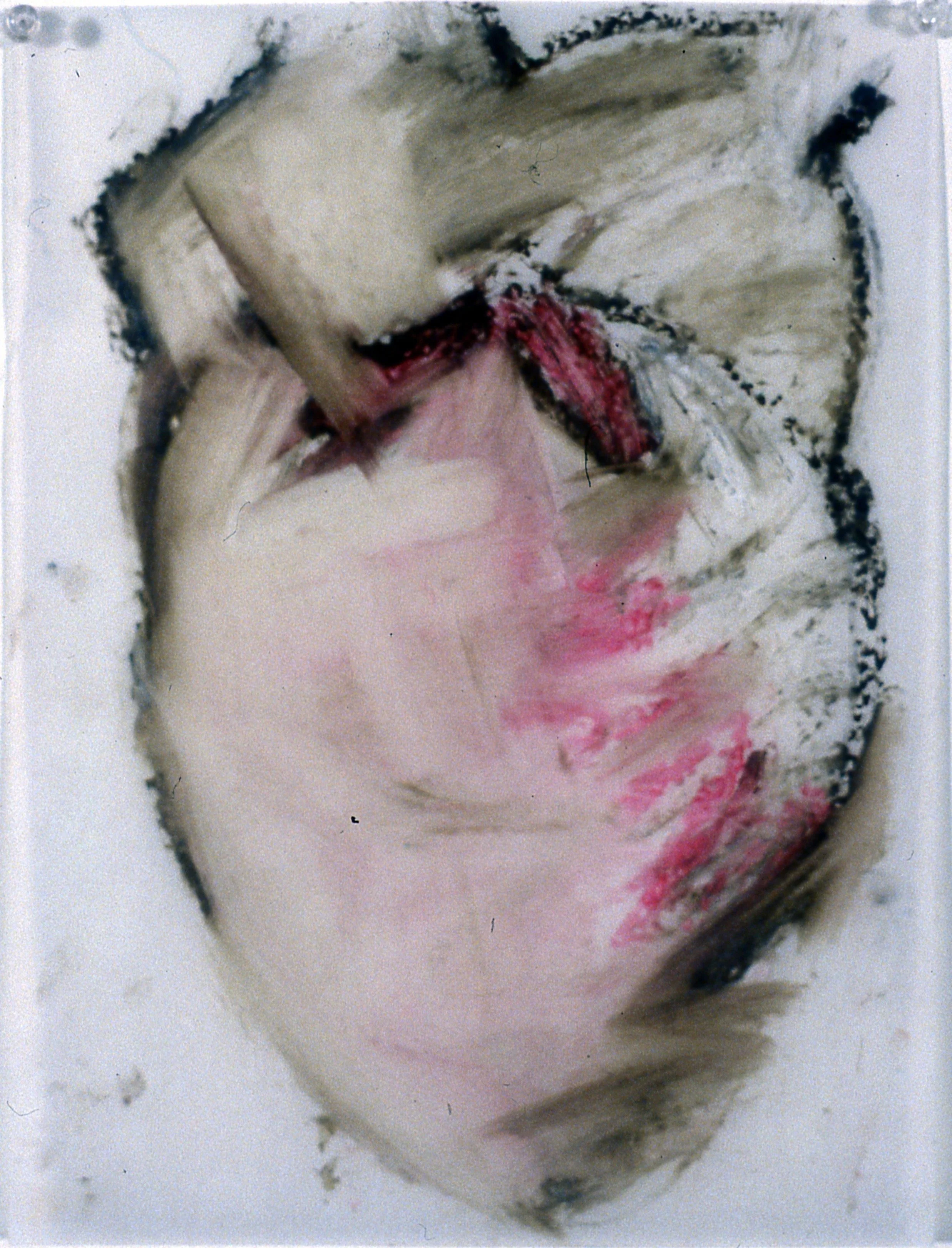 Heart Murmur #2