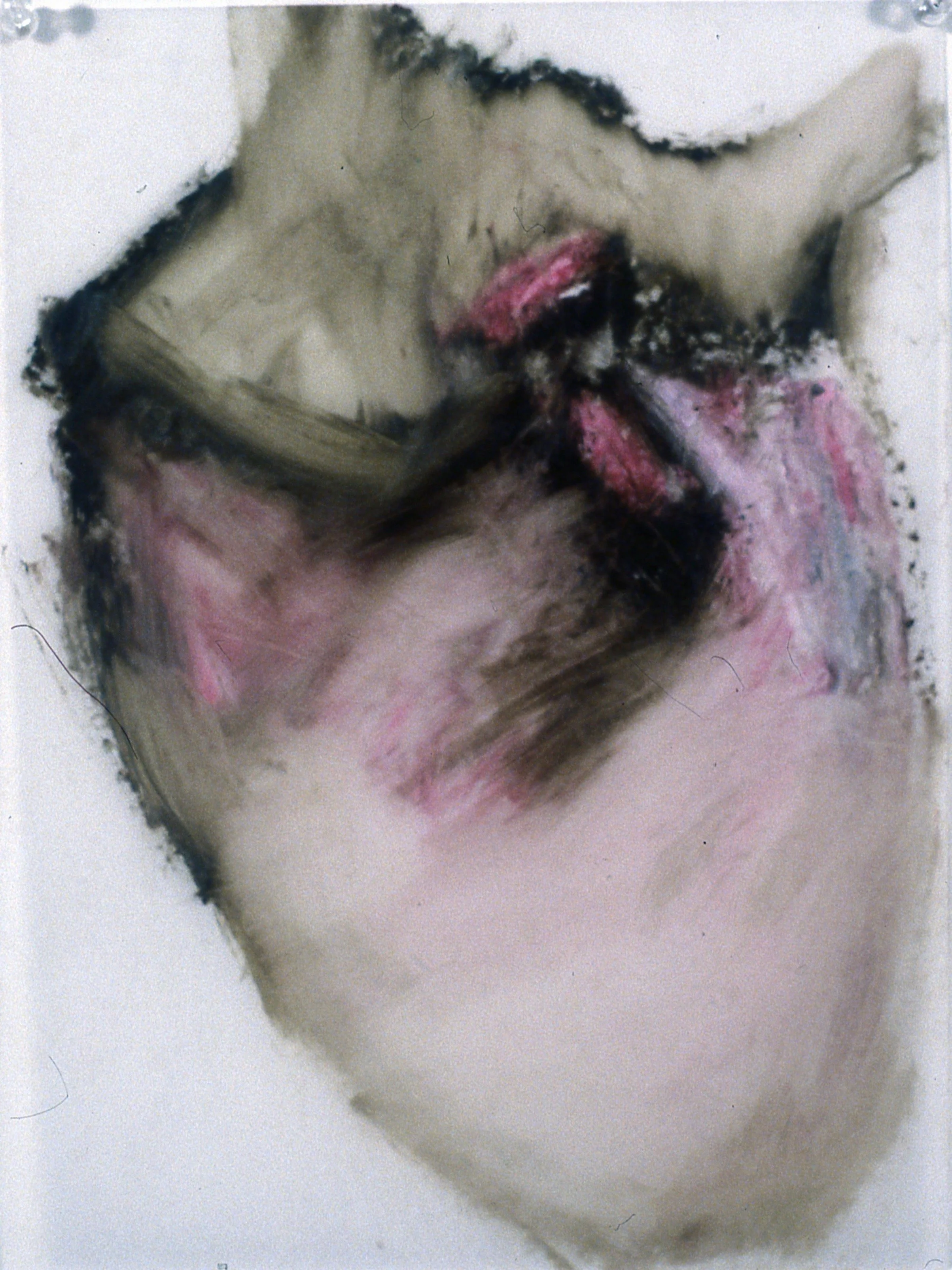 Heart Murmur #3