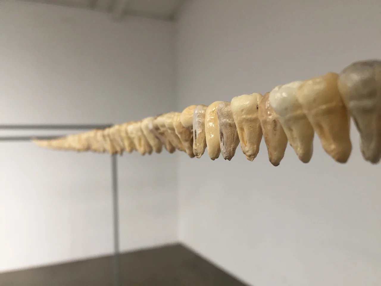 My dad used to come pick me up after my dentist appointments